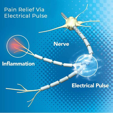 Image of AccuRelief™ Single Channel TENS Device