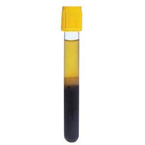 Image of BD Vacutainer Tube, Gold BD Hemogard Closure, 13 x 100mm x 5.0mL