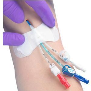 Image of Grip-Lok Securement Device for Universal PICC Catheter, 3-1/2", 1/4" - 1/2" Tubing