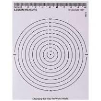 Image of Lesion Measurer (Decubitus Measuring Device)