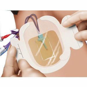 Image of Tegaderm CHG Chlorhexidine Gluconate IV Securement Dressing 3-1/2" x 4-1/2"