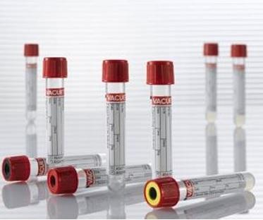 Image of VACUETTE Blood Collection Tube, CAT Serum Separator Clot Activator, Non-Ridged, 13x100, Red Cap with Yellow Ring, 5 mL